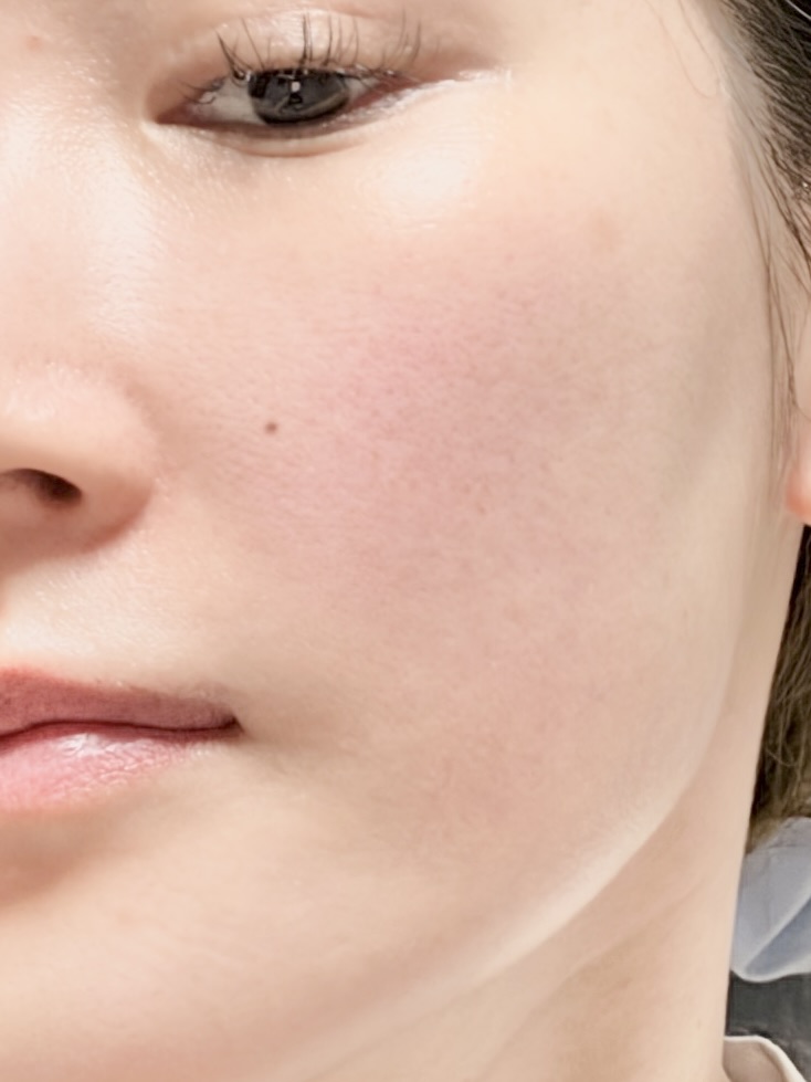 Want Glossy Glass Skin? Dermafix Collagen Mask Gave Me Peeled-Egg Skin